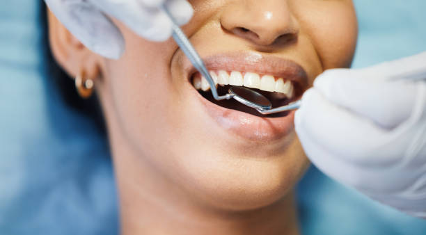 Best Emergency Tooth Extraction in Carleton, MI