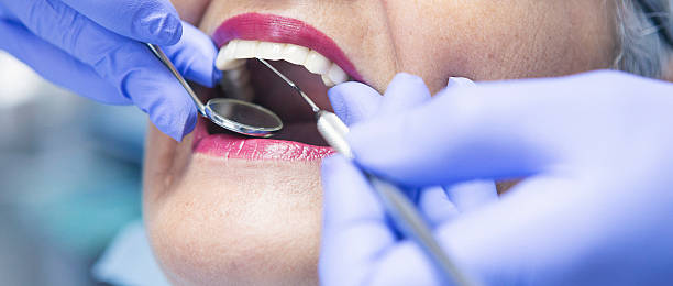 Best Emergency Treatment for Dental Infections or Abscesses in Carleton, MI
